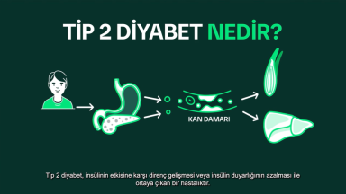 CSF-1 Disease Progress Video 